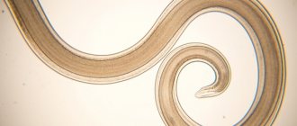 Why are roundworm eggs dangerous?