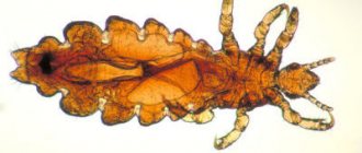 Head lice