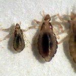 types of lice